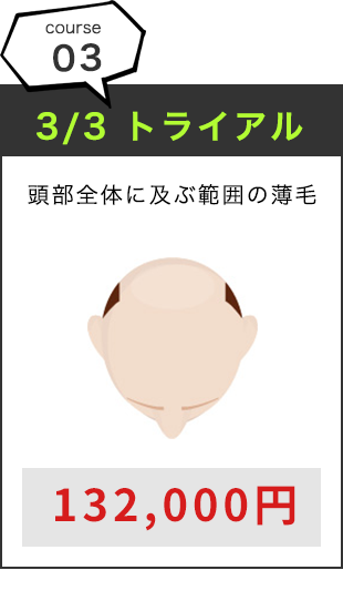 3/3 トライアル