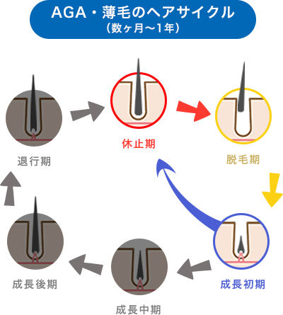 通常のヘアサイクル（2〜6年）